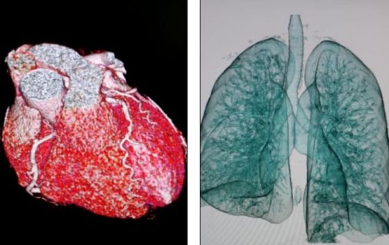 心脏和肺部图像