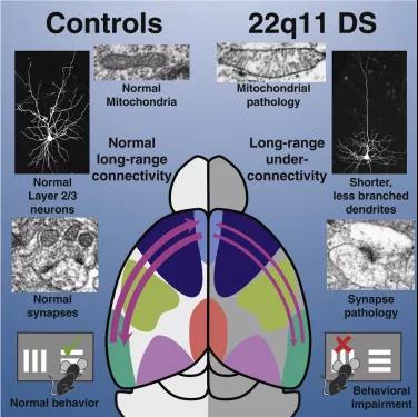 neuron:自闭症或精神分裂 可能是大脑连接不足所致